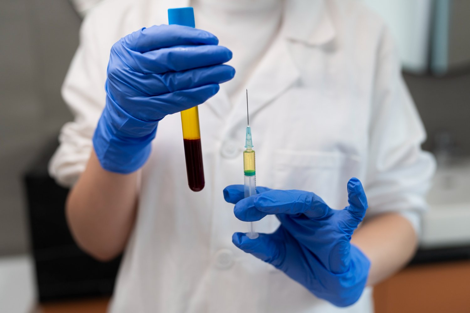 Advanced PRP Technique 